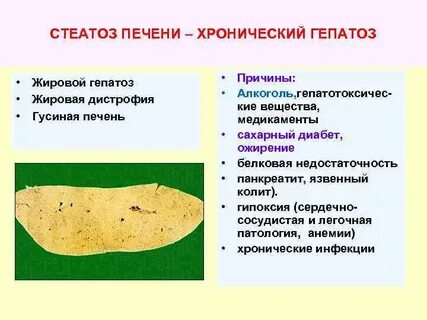 Стеатоз печени симптомы