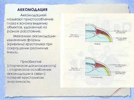 Код нарушение аккомодации