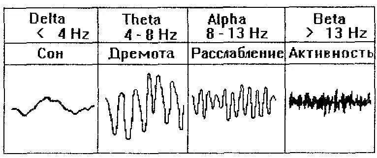 Ритмы мозга Альфа бета тета Дельта ритмы. Альфа волны головного мозга. Альфа волны и бета волны мозга. Дельта волны на ЭЭГ.