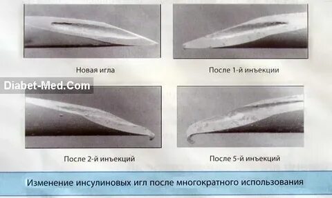 Почему нельзя трогать могильные иглы