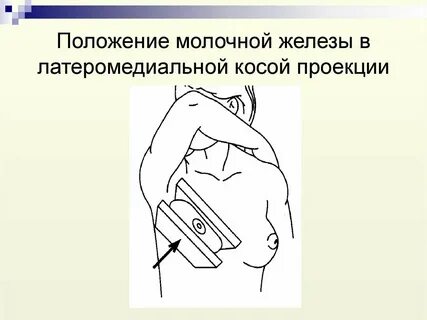 Ваб молочной железы