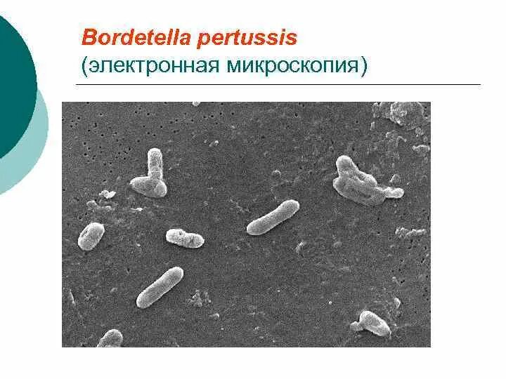Pertussis коклюш. Бордетеллы коклюша микроскопия. Бордетелла пертуссис. Bordetella pertussis микроскопия. Возбудитель коклюша микробиология.