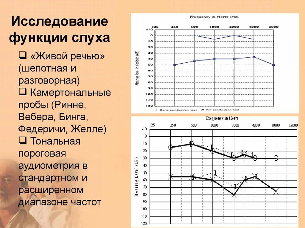 Тональная пороговая и надпороговая аудиометрия. Исследование слуха. Исследование слуха аудиометрия. Исследование слуха живой речью. Аудиограмма в спб