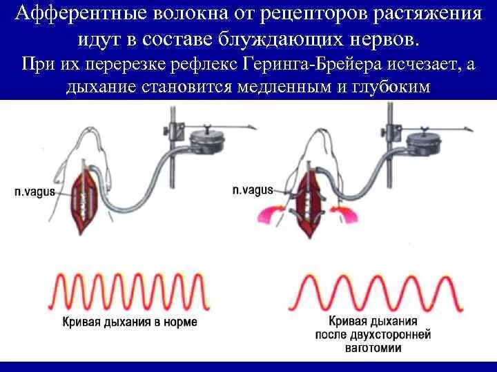 При перерезке блуждающих нервов дыхание. При перерезке блуждающих нервов, сердечный ритм. Рефлекс растяжения Геринга-Брейера. При перерезке блуждающего нерва дыхание становится.