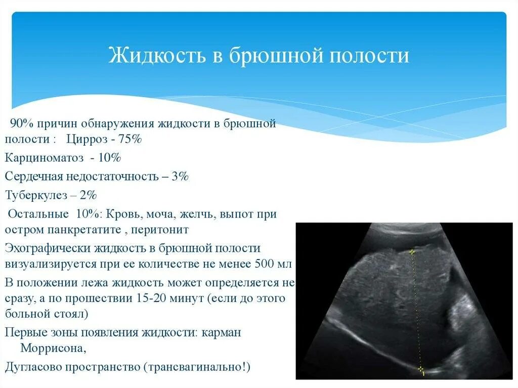 Подготовка к узи печени у взрослых. Жидкость в брюшной полости на узи. свободная жидкость в брюшной полости на узи. узи признаки свободной жидкости в брюшной полости.