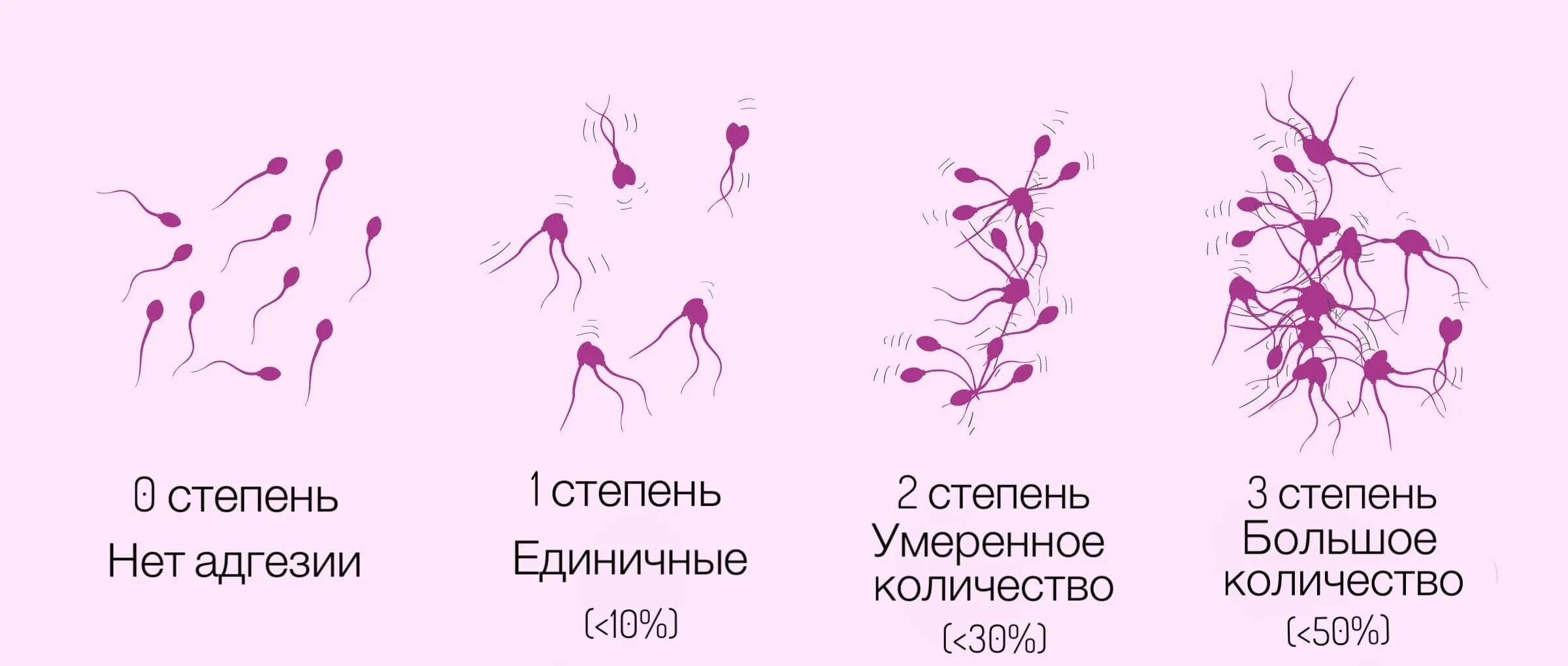 После полового акта через сколько можно забеременеть. Движение сперматозоидов. Подвижность спермиев. Количество мертвых сперматозоидов. Сперматозоид картинка.