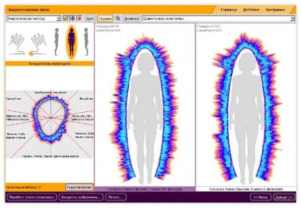 Все ауры в sols rng. Аппарат Кирлиана Аура. Прибор для измерения биополя человека. Аппарат Короткова для измерения Ауры. Прибор измерения биополя Ауры.