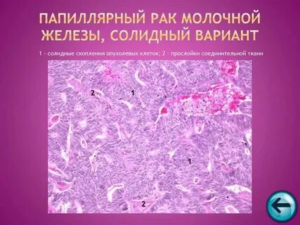 Папиллярные железы