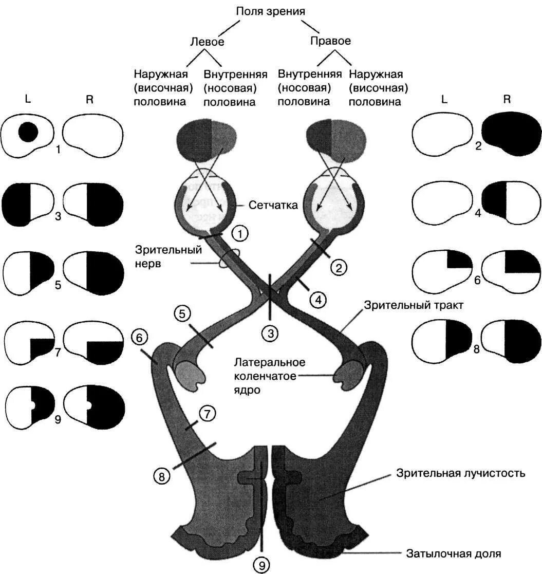 Зрительный нерв неврология схема. Поле зрения. Выпадения поля зрения.. Зрительный нерв выпадение полей зрения. Схема зрительного анализатора выпадение поля зрения. Монимен