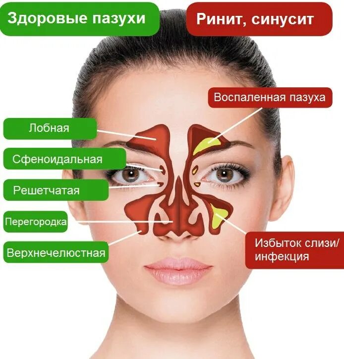 Синусы пазухи. Синусы пазухи