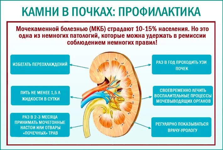 Мочекаменная болезнь причины заболевания. Профилактика образования камней в почках. Мочекаменная болезнь причины и профилактика. Почка при мочекаменной болезни. Формирование конкрементов в почках.