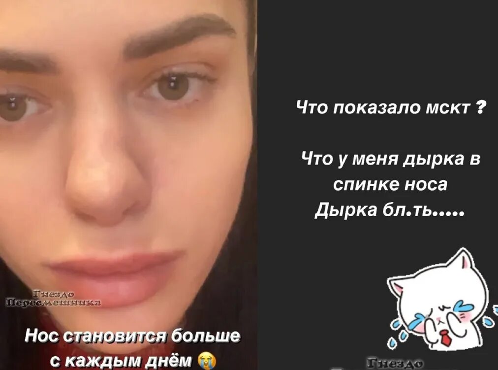 Дом два нос. Балинская нос. анастасия балинская. анастасия балинская провалился нос. у балинской провалился нос.