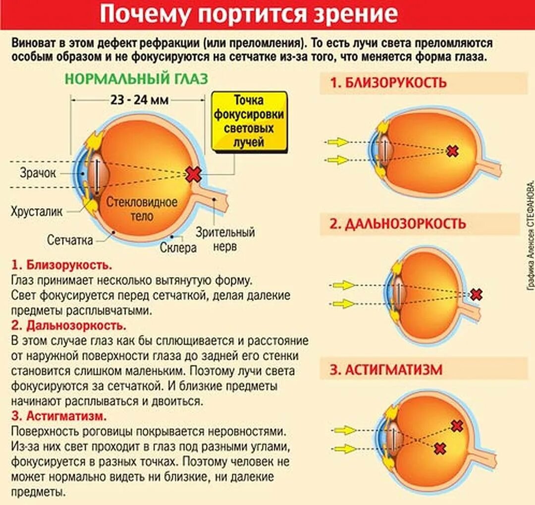 От чему ухудшается 9рение. Исправление при близорукости. От чево уходшаеца зрение. Почему портится зрение.