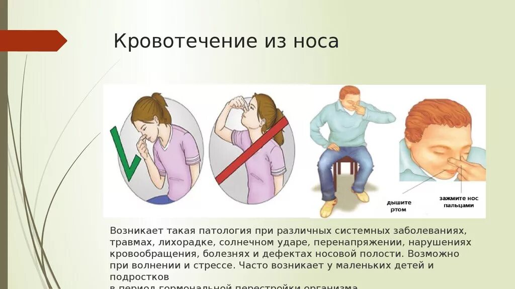 Алгоритм действий при носовом кровотечении. Оказание помощи при носовом кровотечении. положение при носовом кровотечении. способы остановки носового кровотечения. оказание помощи при кровотечении из носа.