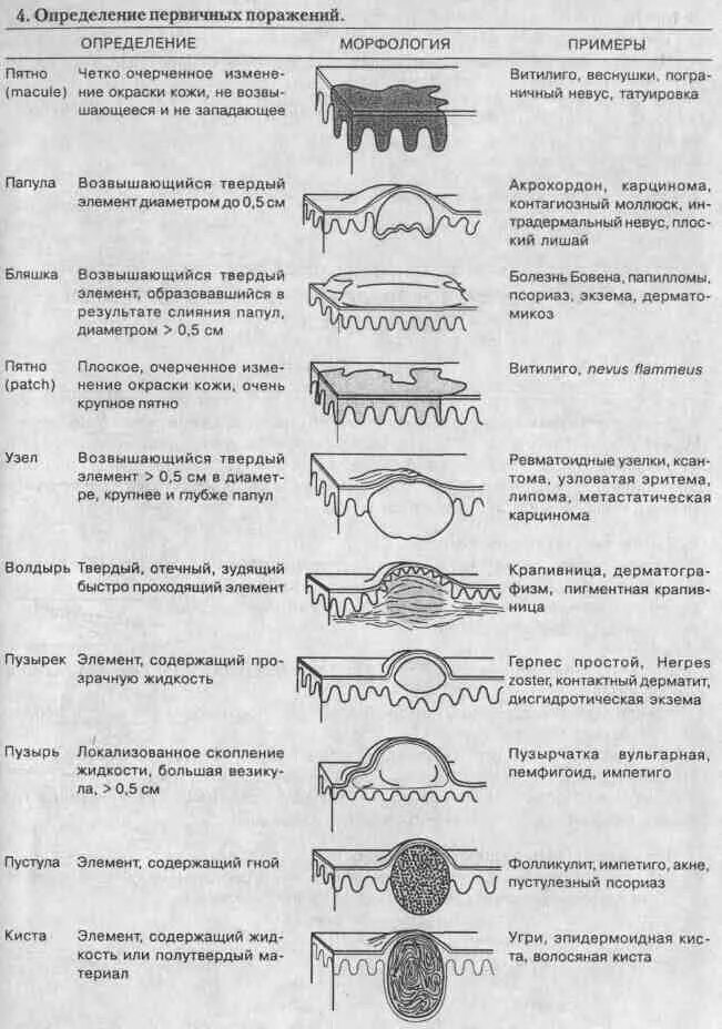 Вторичные элементы поражения