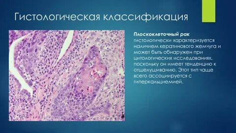 Классификация гистологии