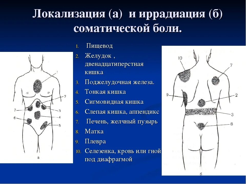 Локализация и иррадиация боли. Боль в желудке локализация. Локализация боли желудка