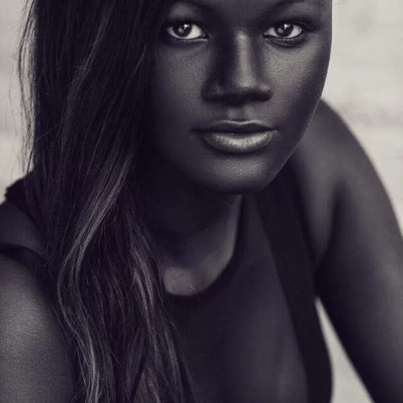 Dark skin color