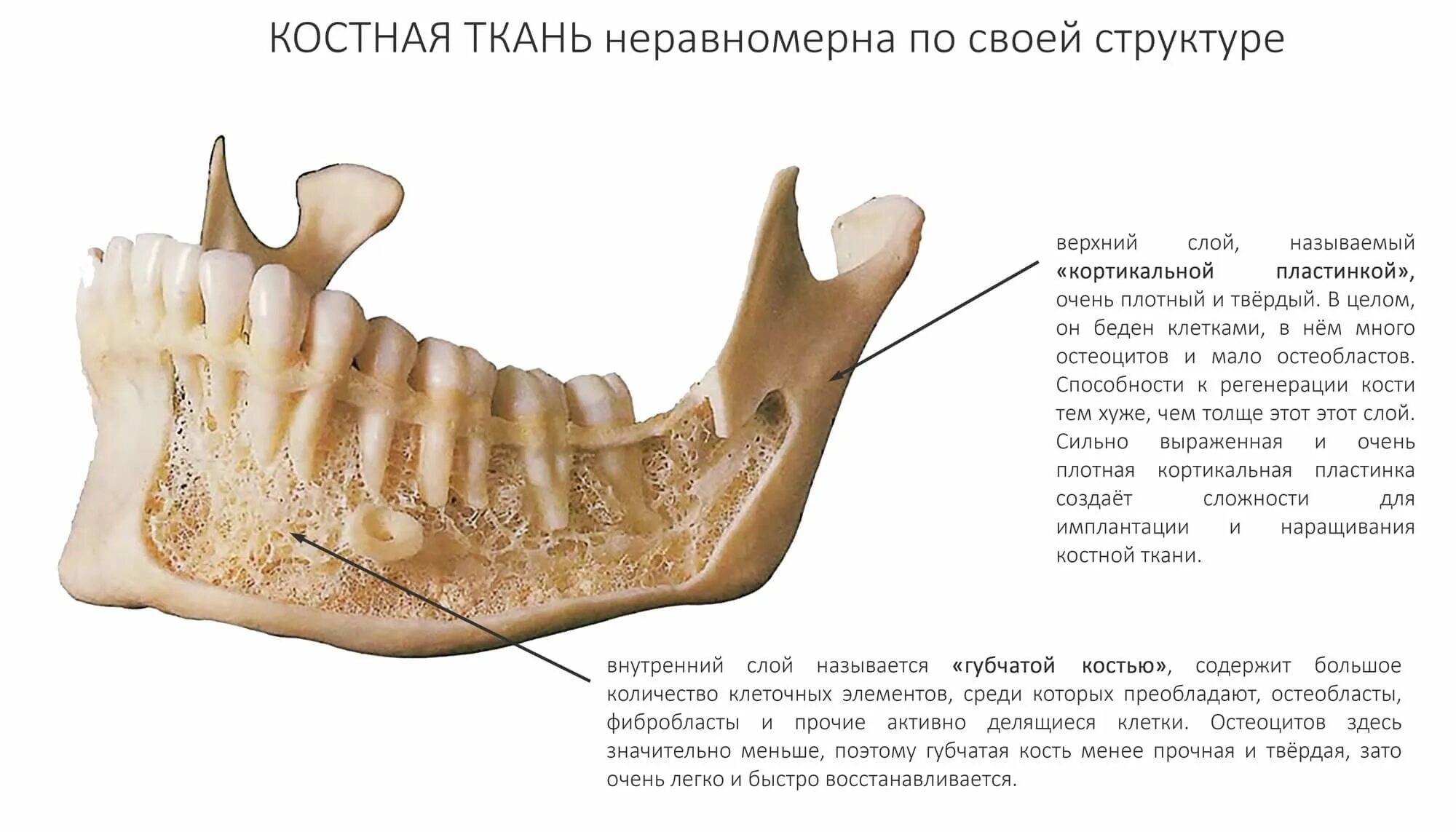 Строение костной ткани в челюсти. Строение костной ткани нижней челюсти. Костная ткань верхней челюсти строение. Челюстная костная ткань.