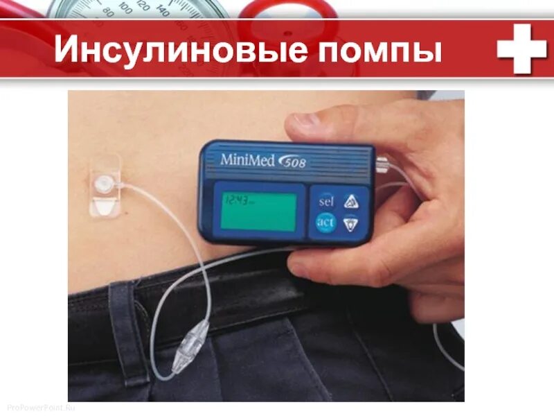 Инструкция инсулиновой помпы. Инсулиновая помпа. диабет инсулиновая помпа. расходники для инсулиновой помпы. инсулиновый насос.