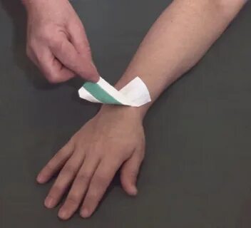 Лейкопластырная повязка