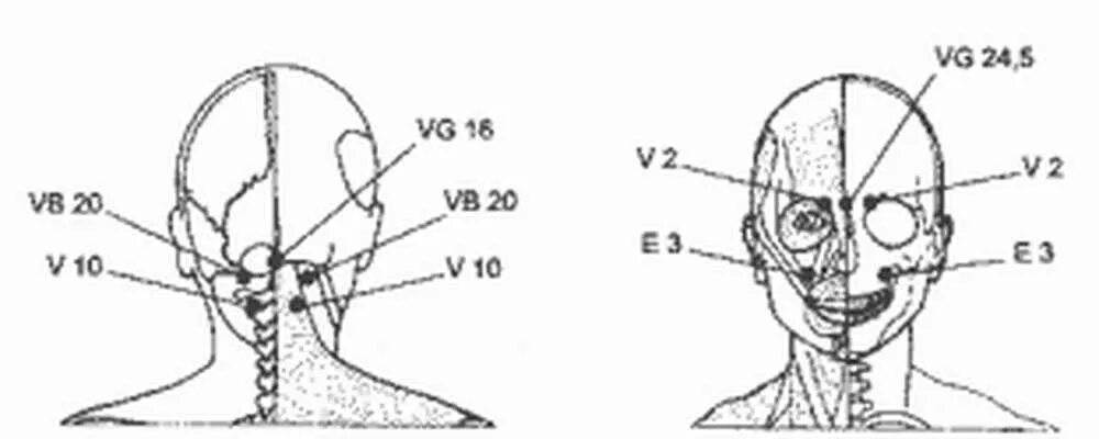 Болезненные точки на голове. Точки при головной боли мигрень. Акупунктурная точка от мигрени. Акупунктурные точки при мигрени. Точки массажа при мигрени.