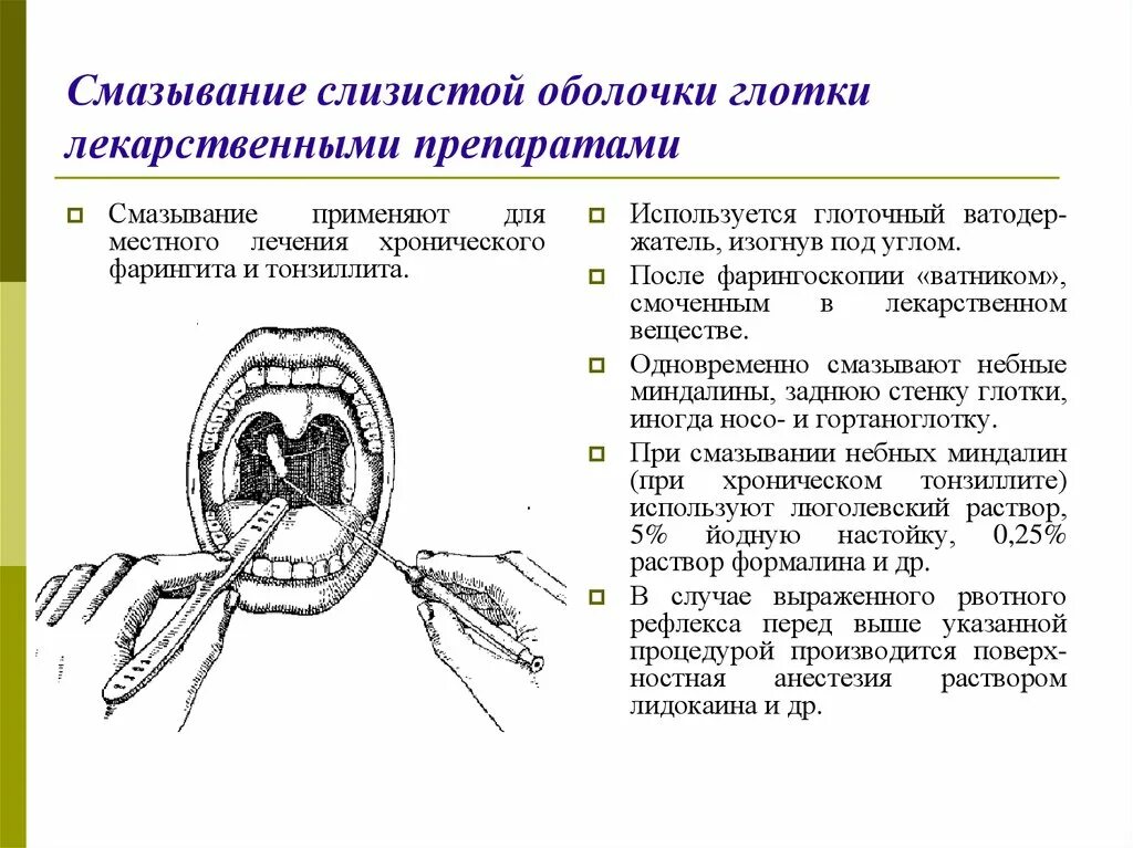 Смазывание слизистой оболочки глотки лекарственными препаратами. Смазывание слизистой глотки алгоритм. Смазывание задней стенки глотки. Смазывание небных миндалин.