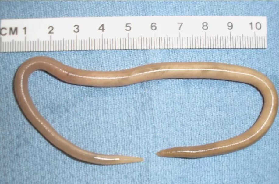 Человеческая аскарида круглый червь. Паразиты черви аскариды. Круглый гельминт Ascaris lumbricoides.