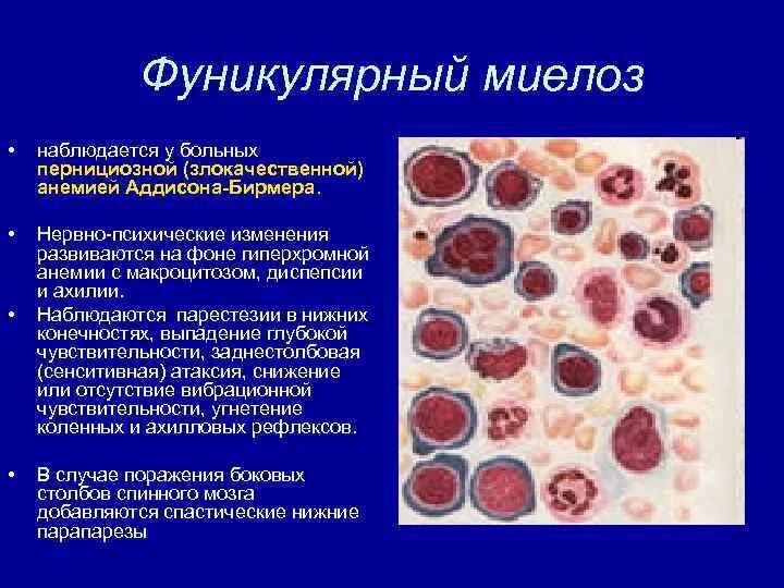 Фуникулярный миелоз при в12 дефицитной анемии. Фуникулярный миелоз при в12 дефицитной анемии