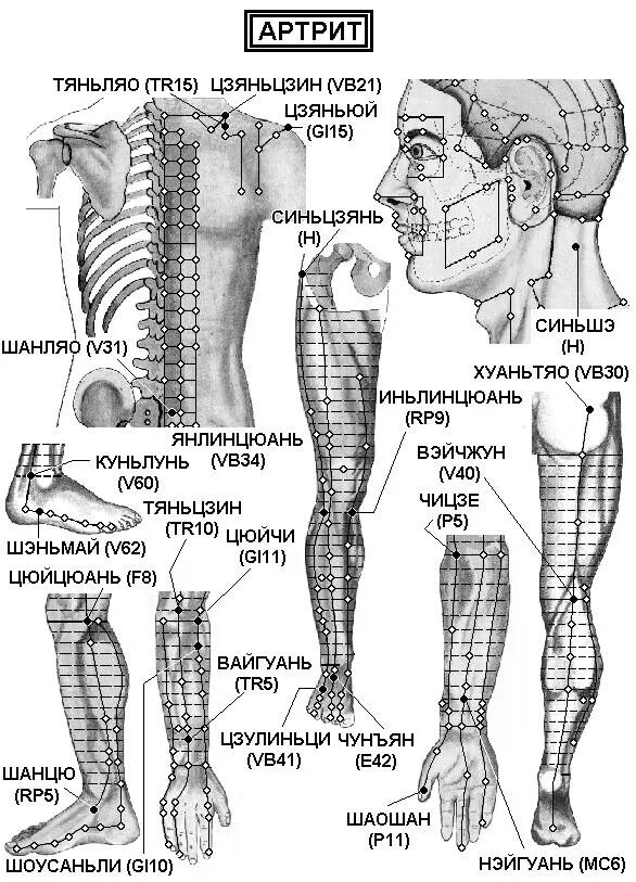 Можно ли массаж при ревматоидном артрите