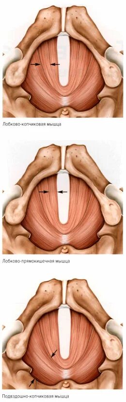 Пирамидальная мышца живота функции. Лобковокопчетая мышца. Переднебоковая стенка живота мышцы. Упражнения для лонно копчиковой мышцы. Лобково корчиклвая мышцы.