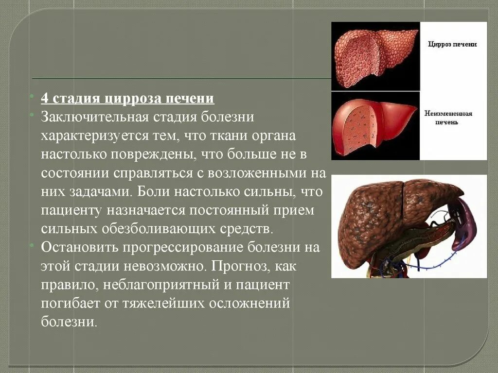 Ранние стадии печени. Этапы развития цирроза печени.