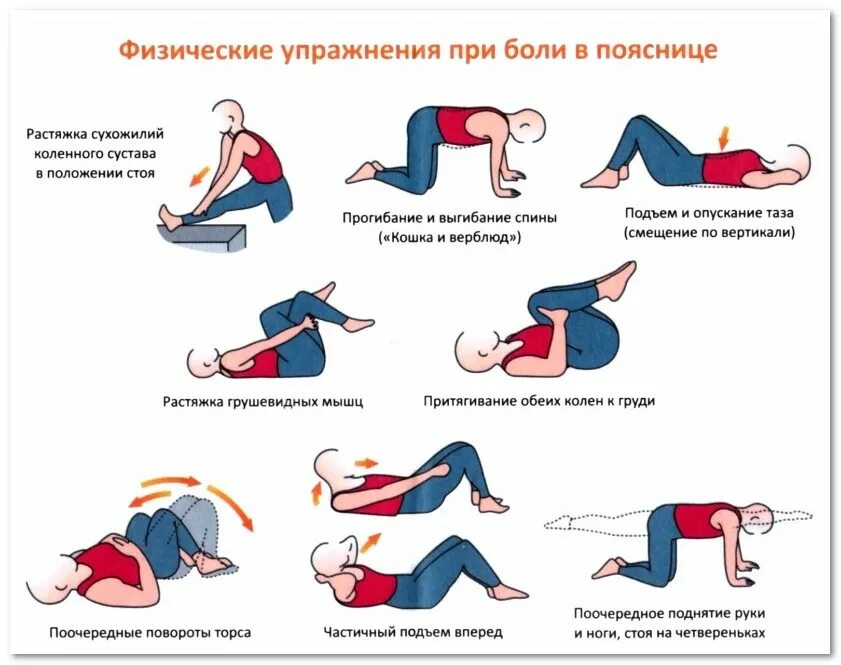 Протрузия дисков лфк