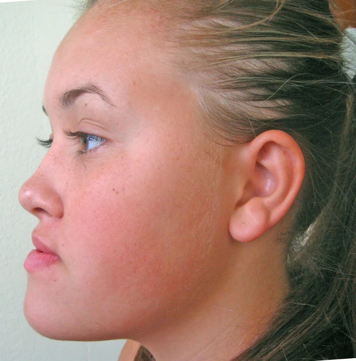 мужские стрижки. мезиальный прикус профиль. части лица человека названия. ментопластика мужская. скошенный подбородок.