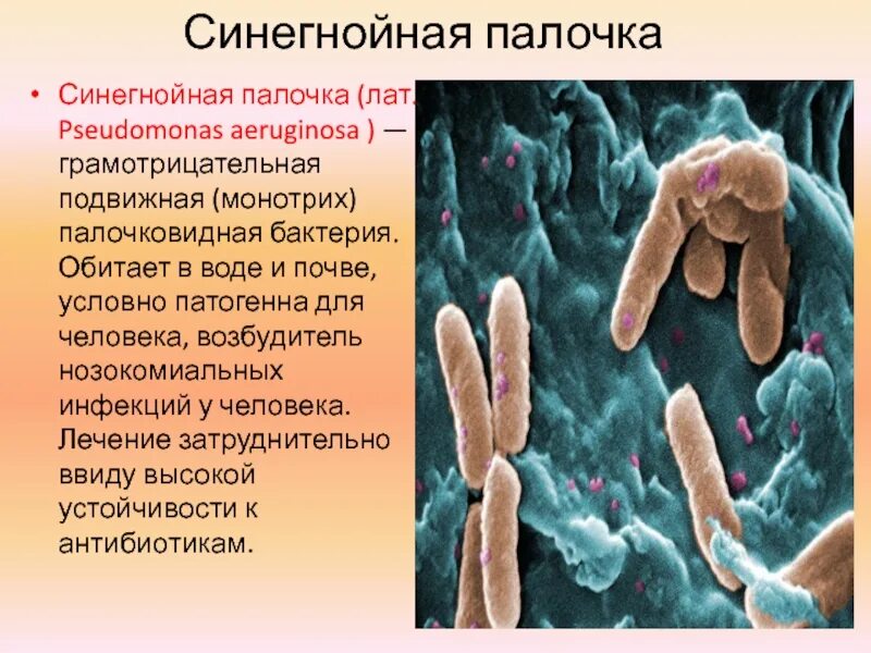 Pseudomonas aeruginosa (синегнойная палочка). Синегнойная палочка пиоцинотипирование. Синегнойная палочка заболевания микробиология. Бактерия псевдомонас аэругиноза что это. Бактерия синегнойная палочка