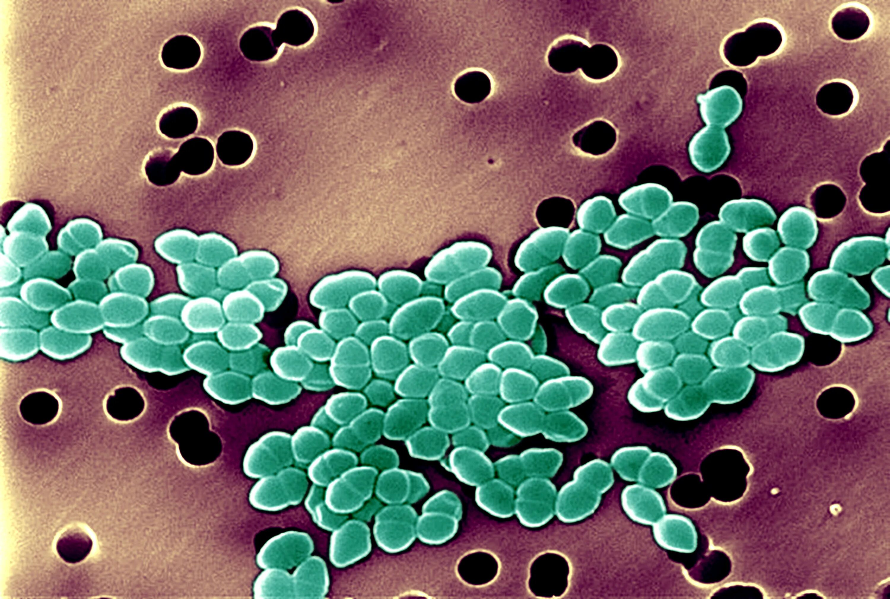 Туберкулез кокки. Энтерококк фэциум. Enterococcus faecium микробиология. Энтерококки микроскопия. Энтерококки faecalis.