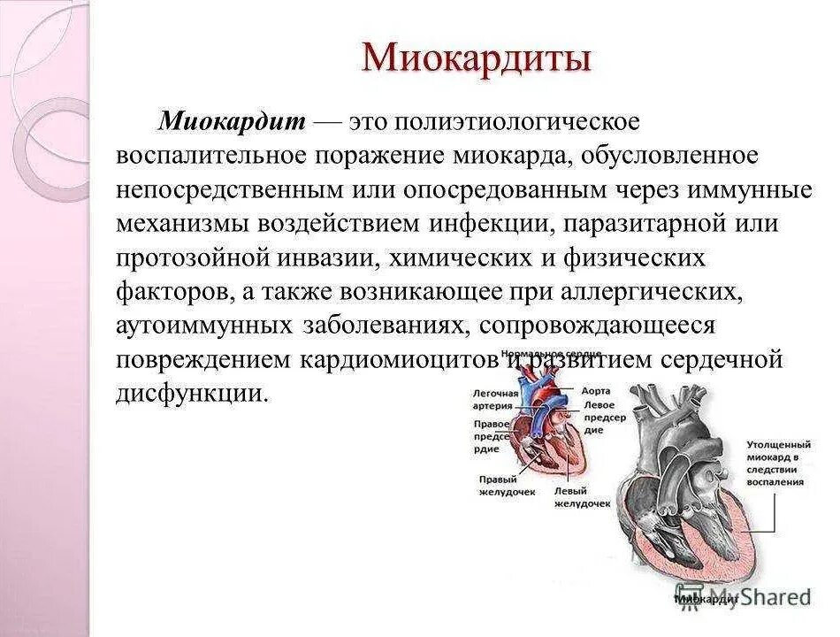Симптомы, характерные для слипчивого перикардита:. Симптомы поражения перикарда. Перикардит миокарда. Этиология заболеваний перикарда. Перикардит инфаркта миокарда.