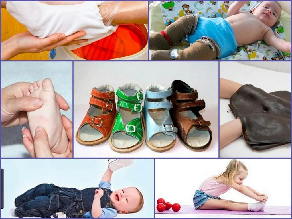 Вальгус какую обувь. Обувь для вальгусной стопы ребенка. Обувь для плоско вальгусных стоп для детей. Ортопедическая обувь для вальгусной стопы для детей. Ортопедическая обувь для детей при вальгусной деформации.