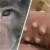First human case of monkeypox confirmed in Czech Republic - monkeypox