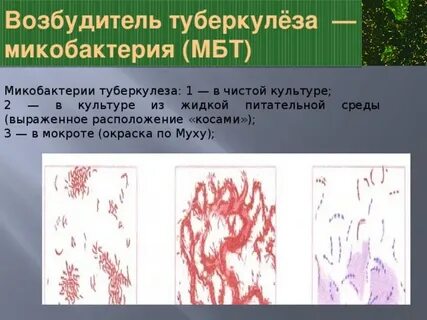 Форма микобактерии туберкулеза