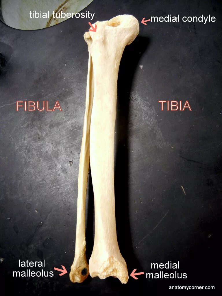 Curved tibia fibula. Fibula bone. tibia bone. tibia кость. тибия анатомия.