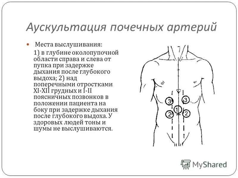Аускультация почечных артерий. Аускультация чревного ствола. Аускультация почечных артерий пропедевтика. Аускультация артерий. Шум в околопупочной области при аускультации.