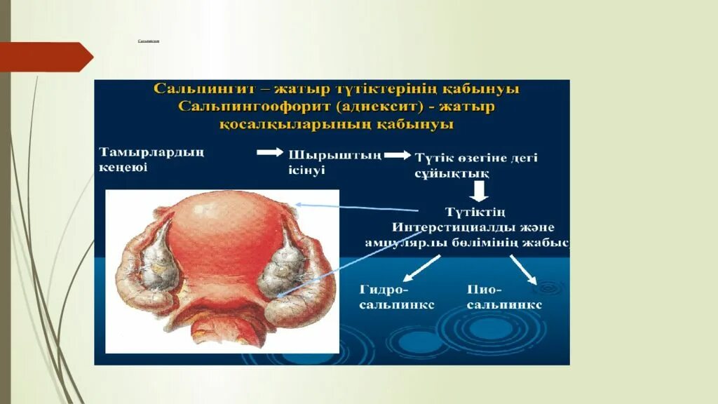 Гонорейный сальпингит. Сальпингит и сальпингоофорит. Сальпингит что это. Хронический сальпингоофорит узи. Острый сальпингоофорит узи.