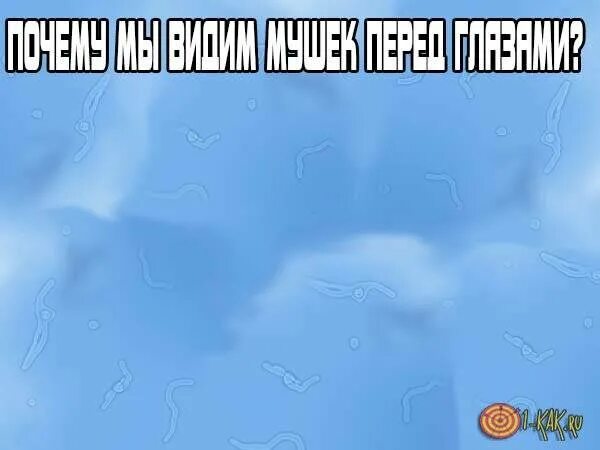 Плавающая черная точка в глазу что это. Чёрные мушки перед глазами. Прозрачные мушки перед глазами. Плавающие мушки в глазах. Пятна перед глазами.