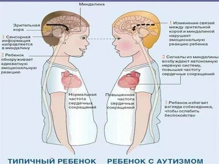 Стимы у детей