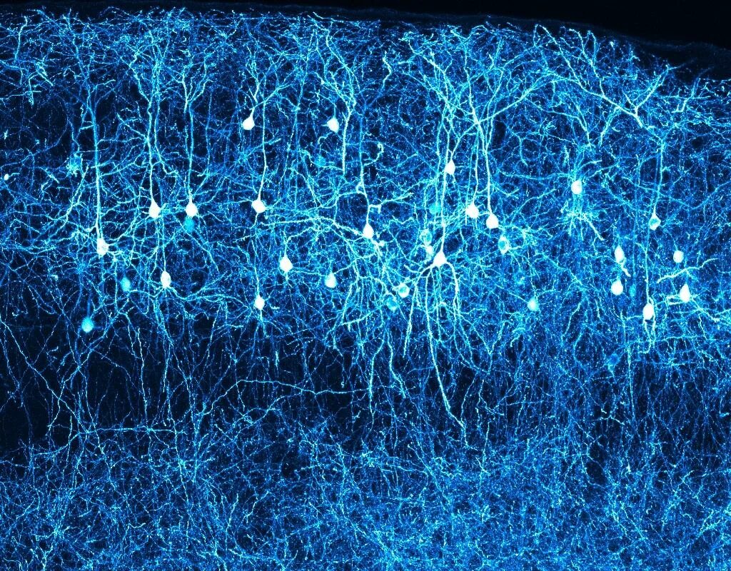 Включает несколько слоев нейронов. Нейроны. Нейроны мозга. Голубые Нейроны. Объемные трехмерные Нейроны.