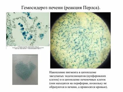 Накопление пигментов