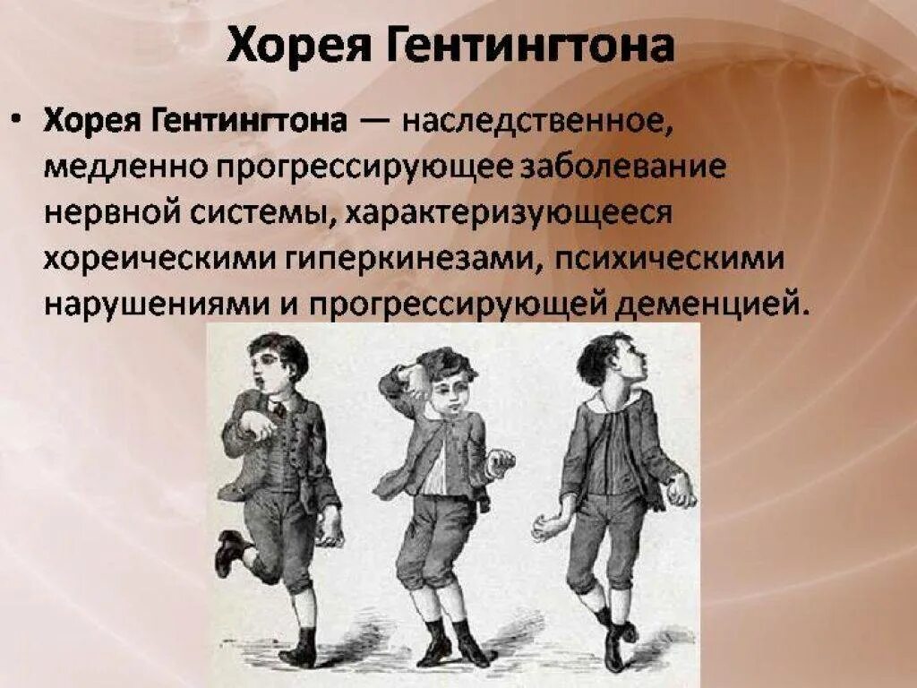 Хорея хантингтона. Синдромы болезни хорея гентингтона. хорея пляска святого витта. ювенильная форма хореи гентингтона. хорея гентингтона (болезнь гентингтона).