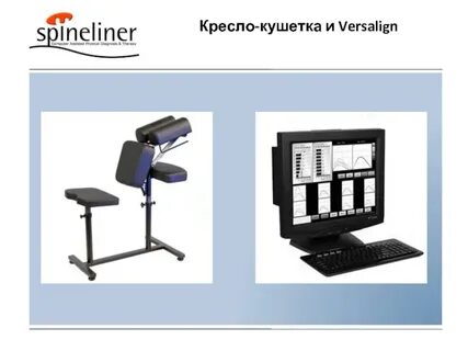 Versalign метод отзывы