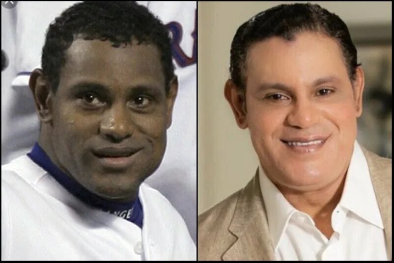 Sammy Sosa. Сэмми Льюис до. Семи Льюис до и после. Сэмми Льюис до пластики. Сэмми льюис до и после